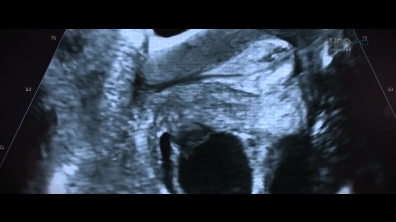 Když se zlomí větev 2016 CZ dab 720p avi